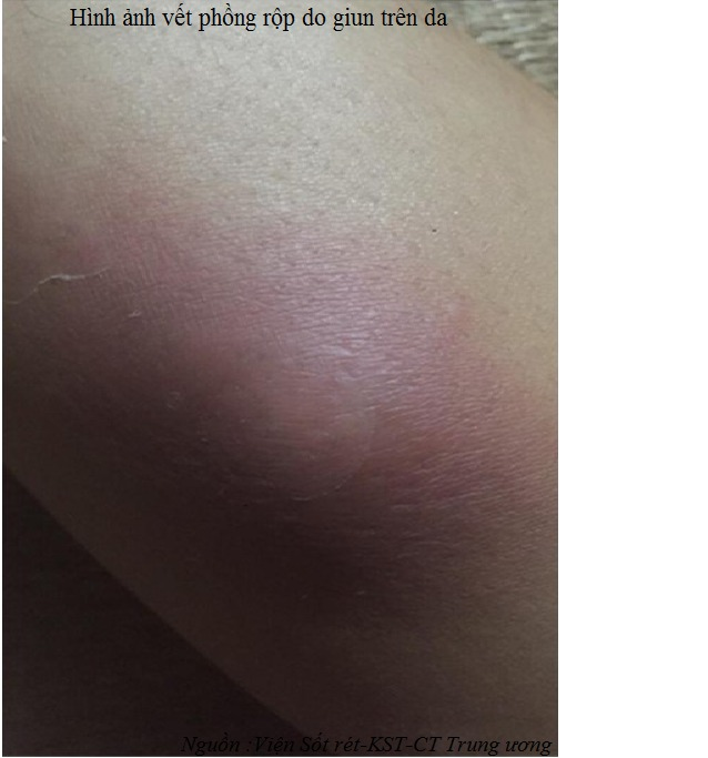 Image from DOCX